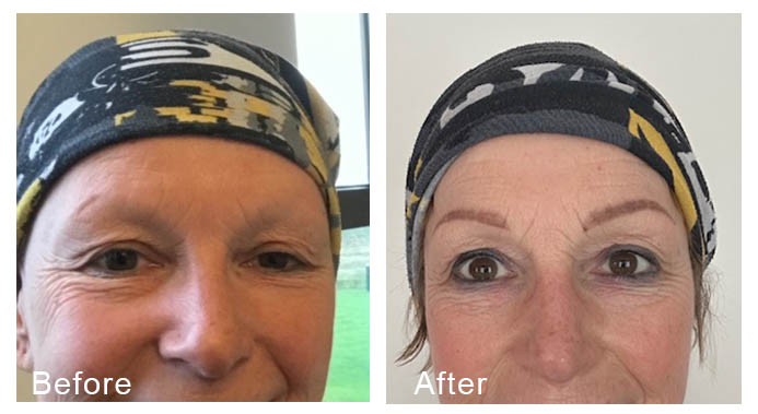 permanente make-up bij uitval gezichtshaar door chemotherapie